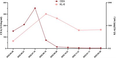 Case Report: Nintedanib for immune-related pneumonitis triggered by anti-PD-1 treatment in a patient with SMARCA4-mutant NSCLC: a case report